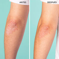 Vegan Hero All-Purpose Balm  40ml-214296 Vegan Hero All-Purpose Balm  40ml-214296 4